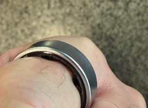 Galaxy Ring заседна на пръста на потребител заради подута батерия (обновено със становище от Samsung)