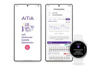 Samsung въвежда още една потенциално животоспасяваща функция в часовниците си