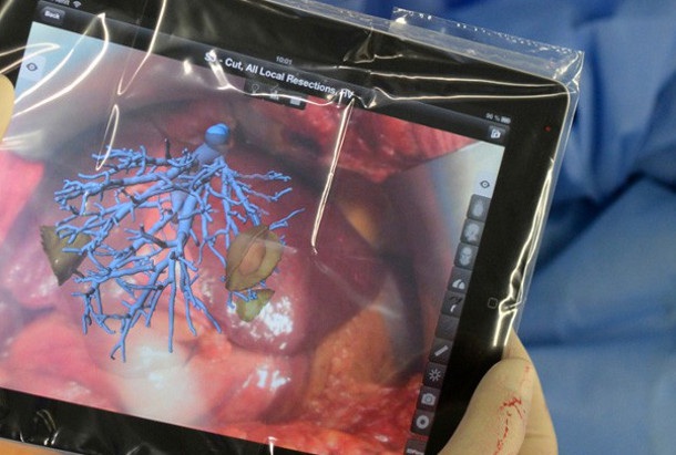 Приложение за iPad на Fraunhoffer ще помага на хирурзи при операции