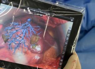 Приложение за iPad на Fraunhoffer ще помага на хирурзи при операции