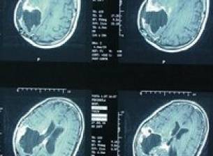 Вредни ли са мобилните телефони?