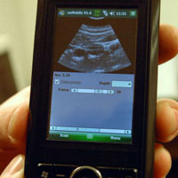 USB ултразвук за Windows Mobile