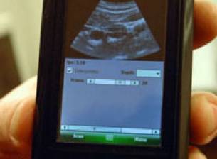 USB ултразвук за Windows Mobile