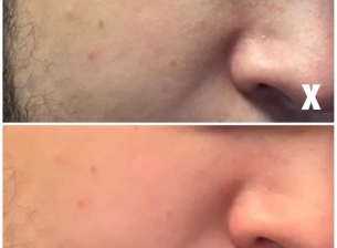 Apple проучва проблеми с предната камера на iPhone Xs